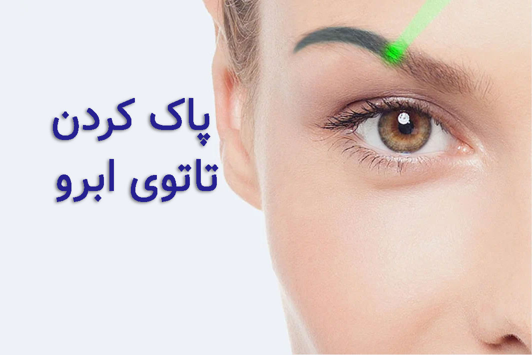 پاک کردن تاتوی ابرو